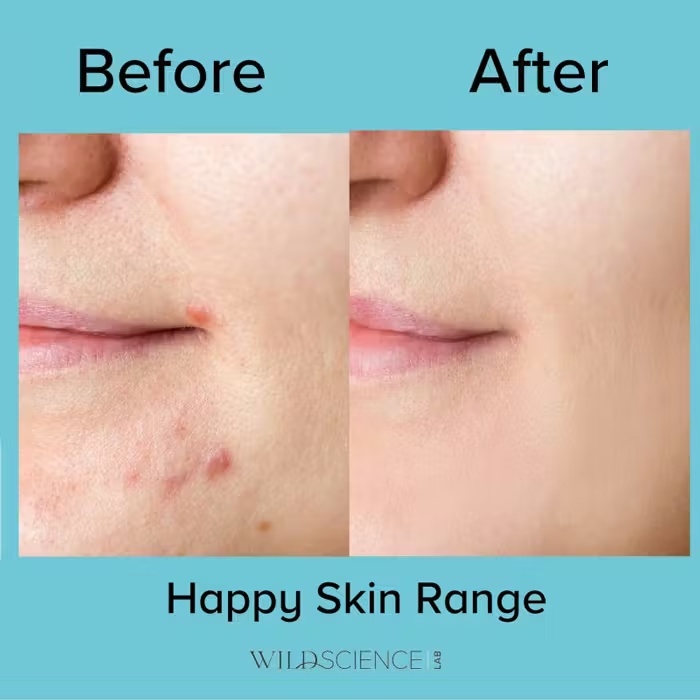 Wild Science LabWild ScienceHappy Place Blemish Gel 30ml 4 Wild Science LabWild ScienceHappy Place Blemish Gel 30ml